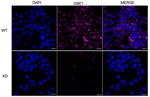 GBE1 Monoclonal Antibody (24GB13015)