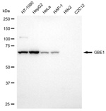 GBE1 Antibody in Western Blot (WB)