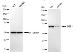GBE1 Antibody in Western Blot (WB)
