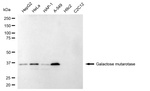 GALM Monoclonal Antibody (24GB13160)
