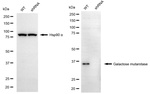 GALM Antibody in Western Blot (WB)