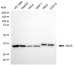 GALE Antibody in Western Blot (WB)