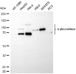 GAA Antibody in Western Blot (WB)