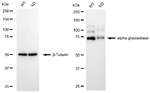 GAA Antibody in Western Blot (WB)