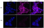 Fumarase Antibody in Immunocytochemistry (ICC/IF)