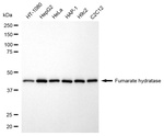 Fumarase Antibody in Western Blot (WB)