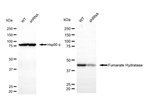 Fumarase Antibody in Western Blot (WB)