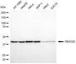 FBXO22 Monoclonal Antibody (24GB8320)