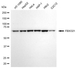 FBXO21 Antibody in Western Blot (WB)