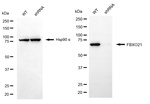 FBXO21 Antibody in Western Blot (WB)