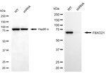 FBXO21 Antibody in Western Blot (WB)