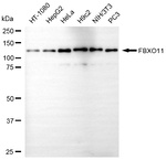 FBXO11 Monoclonal Antibody (25GB520)