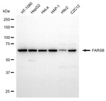 FARSB Monoclonal Antibody (24GB8255)