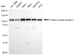 FAK Antibody in Western Blot (WB)
