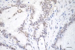 EXOSC7 Antibody in Immunohistochemistry (Paraffin) (IHC (P))