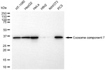 EXOSC7 Antibody in Western Blot (WB)