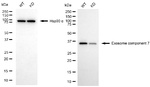 EXOSC7 Antibody in Western Blot (WB)
