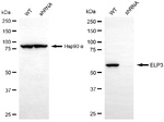 ELP3 Antibody in Western Blot (WB)