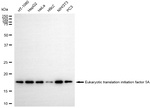 eIF5A Antibody in Western Blot (WB)
