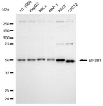 eIF2b gamma Monoclonal Antibody (24GB8150)