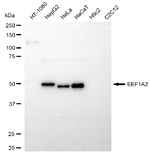 EEF1A2 Recombinant Rabbit Monoclonal Antibody (25GB4655)
