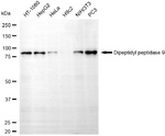 DPP9 Antibody in Western Blot (WB)