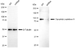 DPP9 Antibody in Western Blot (WB)