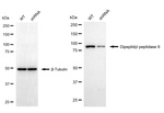 DPP9 Antibody in Western Blot (WB)