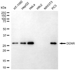 DENR Monoclonal Antibody (25GB2740)