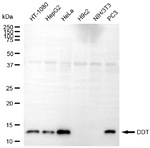 DDT Monoclonal Antibody (25GB4055)