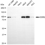 DDR2 Recombinant Rabbit Monoclonal Antibody (25GB2210)