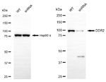 DDR2 Antibody in Western Blot (WB)