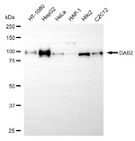 DAB2 Antibody in Western Blot (WB)