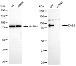 DAB2 Antibody in Western Blot (WB)