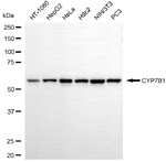 CYP7B1 Antibody in Western Blot (WB)