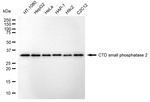 CTDSP2 Monoclonal Antibody (24GB8045)