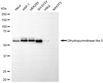 CRMP5 Antibody in Western Blot (WB)