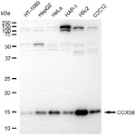 COX5B Antibody in Western Blot (WB)