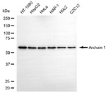 COPD Monoclonal Antibody (25GB5500)