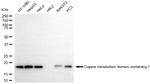 COMMD1 Antibody in Western Blot (WB)