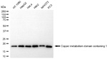COMMD1 Antibody in Western Blot (WB)