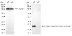 COMMD1 Antibody in Western Blot (WB)