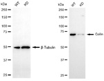 Coilin Antibody in Western Blot (WB)