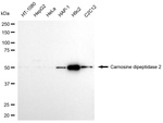 CNDP2 Antibody in Western Blot (WB)