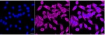 Clathrin Heavy Chain Recombinant Rabbit Monoclonal Antibody (24GB6960)