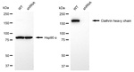 Clathrin Heavy Chain Antibody in Western Blot (WB)