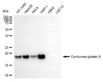CENPA Antibody in Western Blot (WB)