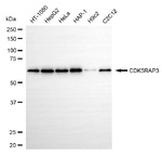 CDK5RAP3 Antibody in Western Blot (WB)