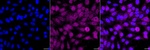 CDA Recombinant Rabbit Monoclonal Antibody (24GB6890)