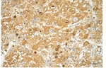 CD206 Antibody in Immunohistochemistry (Paraffin) (IHC (P))